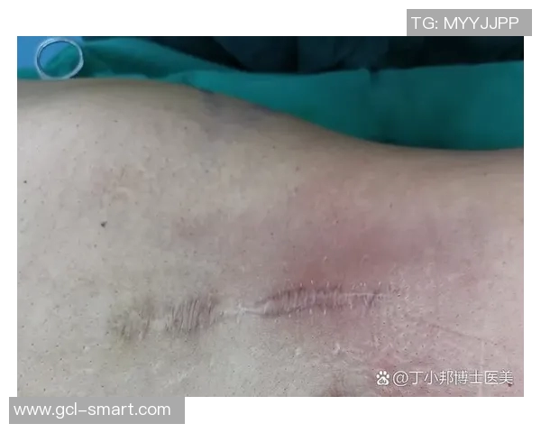 某知名足球明星悄然做医美手术引发热议粉丝纷纷猜测其变化原因